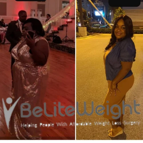 Dekethia T - 2 Year Update*